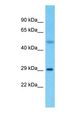 OXCT2 Antibody - Western blot of OXCT2 Antibody with Ovary Tumor lysate.  This image was taken for the unconjugated form of this product. Other forms have not been tested.