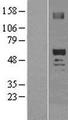OXCT2 Protein - Western validation with an anti-DDK antibody * L: Control HEK293 lysate R: Over-expression lysate