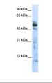 OXSM / KS Antibody - Transfected 293T cell lysate. Antibody concentration: 1.0 ug/ml. Gel concentration: 12%.  This image was taken for the unconjugated form of this product. Other forms have not been tested.