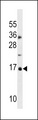 Antibody - hp16-INK4A Antibody (S7) western blot of MDA-MB453 cell line lysates (35 ug/lane). The CDKN2A antibody detected the CDKN2A protein (arrow).