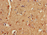 P2RX1 / P2X1 Antibody - Immunohistochemistry of paraffin-embedded human brain tissue using P2RX1 Antibody at dilution of 1:100