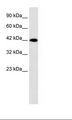 P2RX2 / P2X2 Antibody - Jurkat Cell Lysate.  This image was taken for the unconjugated form of this product. Other forms have not been tested.