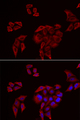 P2RX4 / P2X4 Antibody - Immunofluorescence analysis of U2OS cells.