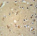 P2RX7 / P2X7 Antibody - P2RX7 Antibody immunohistochemistry of formalin-fixed and paraffin-embedded human brain tissue followed by peroxidase-conjugated secondary antibody and DAB staining.