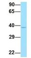 P2RY11 / P2Y11 Antibody - P2RY11 / P2Y11 antibody Western Blot of Human Fetal Liver. Antibody Dilution: 1.0ug/ml. Antibody dilution: 1 ug/ml.  This image was taken for the unconjugated form of this product. Other forms have not been tested.