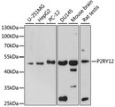 P2RY12 / P2Y12 Antibody - Western blot analysis of extracts of various cell lines, using P2RY12 antibody at 1:1000 dilution. The secondary antibody used was an HRP Goat Anti-Rabbit IgG (H+L) at 1:10000 dilution. Lysates were loaded 25ug per lane and 3% nonfat dry milk in TBST was used for blocking. An ECL Kit was used for detection and the exposure time was 180s.