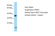 P2RY6 / P2Y6 Antibody -  This image was taken for the unconjugated form of this product. Other forms have not been tested.