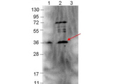 p39 Antibody - Western blot showing detection of 0.1 µg of recombinant p39 protein. Lane 1: Molecular weight markers. Lane 2: MBP-p39 fusion protein (expected MW: 77.8 kDa). Lane 3: MBP alone. Protein was run on a 4-20% gel, then transferred to 0.45 µm nitrocellulose. After blocking with 1% BSA-TTBS overnight at 4°C, primary antibody was used at 1:1000 at room temperature for 30 min. HRP-conjugated Goat-Anti-Rabbit secondary antibody was used at 1:40,000 in MB-070 blocking buffer and imaged on the VersaDoc MP 4000 imaging system (Bio-Rad).