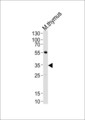 p56lck / LCK Antibody - Western blot of lysate from mouse thymus tissue lysate, using Mouse Lck Antibody. Antibody was diluted at 1:1000 at each lane. A goat anti-rabbit IgG H&L (HRP) at 1:5000 dilution was used as the secondary antibody. Lysate at 35ug per lane.