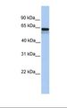 p56lck / LCK Antibody - Fetal heart lysate. Antibody concentration: 1.0 ug/ml. Gel concentration: 12%.  This image was taken for the unconjugated form of this product. Other forms have not been tested.