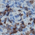 p56lck / LCK Antibody - Immunohistochemical analysis of LCK staining in human lymph node formalin fixed paraffin embedded tissue section. The section was pre-treated using heat mediated antigen retrieval with sodium citrate buffer (pH 6.0). The section was then incubated with the antibody at room temperature and detected using an HRP polymer system. DAB was used as the chromogen. The section was then counterstained with hematoxylin and mounted with DPX.