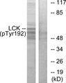 p56lck / LCK Antibody - Western blot analysis of lysates from Jurkat cells, using Lck (Phospho-Tyr192) Antibody. The lane on the right is blocked with the phospho peptide.