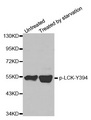 p56lck / LCK Antibody - Western blot analysis of extracts from JK cells.