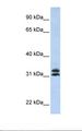 P5CR2 / PYCR2 Antibody - HepG2 cell lysate. Antibody concentration: 1.0 ug/ml. Gel concentration: 12%.  This image was taken for the unconjugated form of this product. Other forms have not been tested.