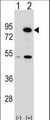 p84 / THOC1 Antibody - Western blot of THOC1 (arrow) using rabbit polyclonal THOC1 Antibody. 293 cell lysates (2 ug/lane) either nontransfected (Lane 1) or transiently transfected (Lane 2) with the THOC1 gene.