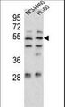 PA26 / SESN1 Antibody - Sestrin-1 Antibody western blot of NCI-H460,HL-60 cell line lysates (35 ug/lane). The Sestrin-1 antibody detected the Sestrin-1 protein (arrow).