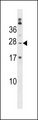 PABPC1L2A Antibody - PABPC1L2B Antibody western blot of K562 cell line lysates (35 ug/lane). The PABPC1L2B antibody detected the PABPC1L2B protein (arrow).