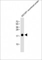 PACAP Antibody - Anti-ADCYAP1 Antibody at 1:8000 dilution + ADCYAP1 recombinant protein Lysates/proteins at 20ng per lane. Secondary Goat Anti-mouse IgG, (H+L), Peroxidase conjugated at 1/10000 dilution. Predicted band size: 18 kDa Blocking/Dilution buffer: 5% NFDM/TBST.