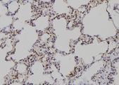 PADI4 / PAD4 Antibody - 1:100 staining rat lung tissue by IHC-P. The sample was formaldehyde fixed and a heat mediated antigen retrieval step in citrate buffer was performed. The sample was then blocked and incubated with the antibody for 1.5 hours at 22°C. An HRP conjugated goat anti-rabbit antibody was used as the secondary.