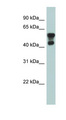 PAFAH1B1 / LIS1 Antibody - PAFAH1B1 / LIS1 antibody Western blot of Fetal Lung lysate. This image was taken for the unconjugated form of this product. Other forms have not been tested.