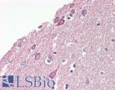 PAFAH1B1 / LIS1 Antibody - Anti-LIS1 antibody IHC of human brain, cortex. Immunohistochemistry of formalin-fixed, paraffin-embedded tissue after heat-induced antigen retrieval. Antibody dilution 5-7.5 ug/ml.  This image was taken for the unconjugated form of this product. Other forms have not been tested.