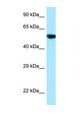 PAG1 Antibody - PAG1 / PAG antibody Western blot of 721_B Cell lysate. Antibody concentration 1 ug/ml.  This image was taken for the unconjugated form of this product. Other forms have not been tested.