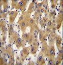 PAGE5 Antibody - PAGE5 Antibody immunohistochemistry of formalin-fixed and paraffin-embedded human liver tissue followed by peroxidase-conjugated secondary antibody and DAB staining.