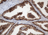 PAI-RBP1 / SERBP1 Antibody - IHC of paraffin-embedded Human prostate tissue using anti-SERBP1 mouse monoclonal antibody. (Heat-induced epitope retrieval by 10mM citric buffer, pH6.0, 120°C for 3min).