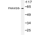 PAK4 + PAK5 + PAK6 Antibody - Western blot of PAK4/5/6 (V469) pAb in extracts from K562 cell treated with PMA 125ng/ml 30'.