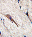 PAK7/PAK5 Antibody - Formalin-fixed and paraffin-embedded human brain tissue reacted with PAK5 antibody, which was peroxidase-conjugated to the secondary antibody, followed by DAB staining. This data demonstrates the use of this antibody for immunohistochemistry; clinical relevance has not been evaluated.