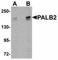 PALB2 Antibody - Western blot of PALB2 in SK-N-SH cell lysate with PALB2 antibody at (A) 1 and (B) 2 ug/ml.