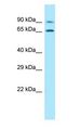 PALMD Antibody - PALMD antibody Western Blot of Jurkat.  This image was taken for the unconjugated form of this product. Other forms have not been tested.