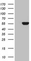 PALS2 / MPP6 Antibody - HEK293T cells were transfected with the pCMV6-ENTRY control. (Left lane) or pCMV6-ENTRY MPP6. (Right lane) cDNA for 48 hrs and lysed
