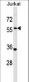 PANX1 / Pannexin 1 Antibody - PANX1 Antibody western blot of Jurkat cell line lysates (35 ug/lane). The PANX1 antibody detected the PANX1 protein (arrow).