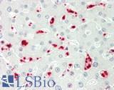 PAPD5 Antibody - Human Liver: Formalin-Fixed, Paraffin-Embedded (FFPE).  This image was taken for the unconjugated form of this product. Other forms have not been tested.