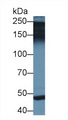 PAPPA2 / Pappalysin 2 Antibody - Western Blot; Sample: Rat Placenta lysate; Primary Ab: 2µg/ml Rabbit Anti-Human PAPPA2 Antibody Second Ab: 0.2µg/mL HRP-Linked Caprine Anti-Rabbit IgG Polyclonal Antibody