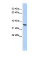 PAQR6 Antibody - PAQR6 antibody Western blot of HepG2 cell lysate. This image was taken for the unconjugated form of this product. Other forms have not been tested.