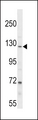 PARG Antibody - PARG Antibody western blot of NCI-H292 cell line lysates (35 ug/lane). The PARG antibody detected the PARG protein (arrow).