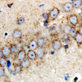 PARK2 / Parkin 2 Antibody - Immunohistochemical analysis of Parkin staining in human brain formalin fixed paraffin embedded tissue section. The section was pre-treated using heat mediated antigen retrieval with sodium citrate buffer (pH 6.0). The section was then incubated with the antibody at room temperature and detected using an HRP conjugated compact polymer system. DAB was used as the chromogen. The section was then counterstained with hematoxylin and mounted with DPX.