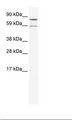 PARN Antibody - SP2/0 Cell Lysate.  This image was taken for the unconjugated form of this product. Other forms have not been tested.