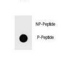 PARP1 Antibody - Dot blot of Phospho-PARP1-S864 Antibody Phospho-specific antibody on nitrocellulose membrane. 50ng of Phospho-peptide or Non Phospho-peptide per dot were adsorbed. Antibody working concentrations are 0.6ug per ml.