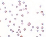 PARP13 / ZC3HAV1 Antibody - Immunocytochemistry of ZC3HAV1 in HeLa cells with ZC3HAV1 antibody at 20 ug/ml.