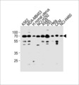 PARP3 Antibody - PARP3 Antibody western blot of K562,MDA-MB453,NCI-H292,A549,293,HeLa,CEM,NCI-H460 cell line and human normal uterus tissue lysates (35 ug/lane). The PARP3 antibody detected the PARP3 protein (arrow).