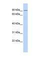 PARP7 / TIPARP Antibody - TIPARP antibody Western blot of Fetal Heart lysate. This image was taken for the unconjugated form of this product. Other forms have not been tested.