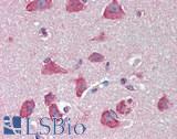 ACHE / Acetylcholinesterase Antibody - Human Brain, Cortex: Formalin-Fixed, Paraffin-Embedded (FFPE), at a dilution of 1:100. 