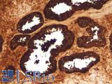 ACPP / PAP Antibody - Human Prostate: Formalin-Fixed, Paraffin-Embedded (FFPE)