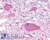 ADGRB3 / BAI3 Antibody - Anti-BAI3 antibody IHC of human brain, neurons. Immunohistochemistry of formalin-fixed, paraffin-embedded tissue after heat-induced antigen retrieval.