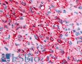 ADGRD1 / GPR133 Antibody - Brain, Glioblastoma