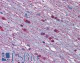 ADRA1A Antibody - Brain Cerebellum White Matter