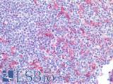 AIF1 / IBA1 Antibody - Human Tonsil: Formalin-Fixed, Paraffin-Embedded (FFPE)
